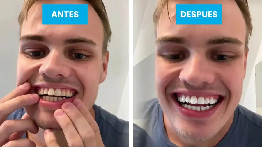 Antes y después del cepillado