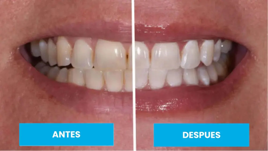 Antes y después, sonrisa en primer plano